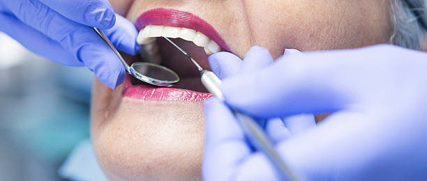 Best Dental Abscess Treatment in Athens, TX
